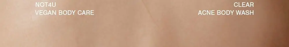[국민트러블바디워시] 낫포유 등드름/가드름 클리어 아크네 바디워시 500ml 상세페이지 28